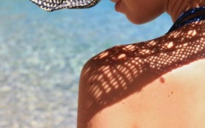 Chỉ dẫn nhận biết nhanh bạn bị sốc nhiệt hay kiệt sức do nắng nóng?