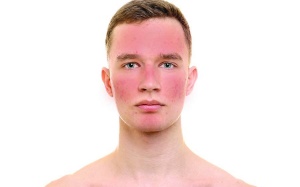 Tập thể dục có thực sự tốt cho làn da?