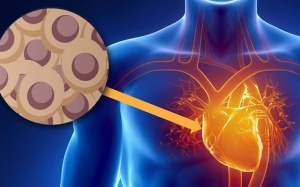 Điều trị suy tim bằng tế bào gốc: Tái tạo thành công mô tim tổn thương  