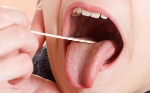 Nguyên nào gây sỏi amidan và có nên lấy sỏi amidan không? 