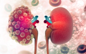 Chế độ ăn tốt cho người bệnh đái tháo đường bị biến chứng suy thận