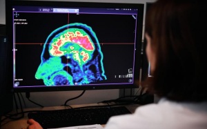 Mới: Sinh viên Ohio tìm ra loại thuốc điều trị ung thư não