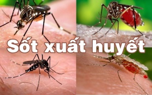 7 quan niệm sai lầm về sốt xuất huyết 