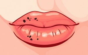 7 dấu hiệu bất thường ở môi cảnh báo vấn đề sức khỏe