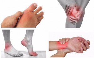 Làm sao để giảm đau khi bị viêm xương khớp? 