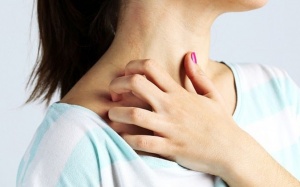 8 cách giảm ngứa khi bị vẩy nến