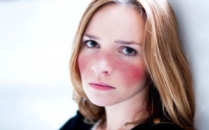 Nguyên nhân nào gây bệnh lupus ban đỏ?