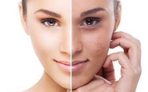 Khuôn mặt của bạn nói gì về sức khỏe? 