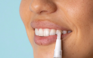 Ngoài đánh răng và đi nha sỹ, còn sản phẩm nào giúp làm trắng răng?