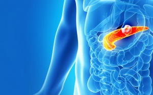 Video: 7 dấu hiệu của bệnh ung thư tuyến tụy không được bỏ qua