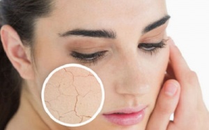 Ngăn ngừa khô da mùa Đông bằng các biện pháp tự nhiên