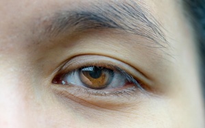 Video: Biện pháp tự nhiên giúp giảm sụp mí mắt đơn giản tại nhà