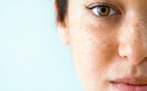 Kế hoạch điều trị nám da và nuôi dưỡng làn da tươi trẻ mỗi ngày