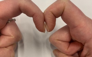 Chuyên gia chia sẻ cách đơn giản tự phát hiện ung thư phổi chỉ mất vài giây