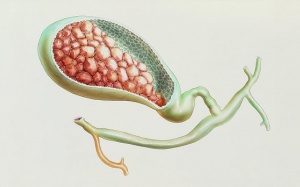 8 điều bạn có thể làm để phòng ngừa sỏi mật