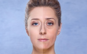 Chăm sóc kỹ lưỡng nhưng da vẫn bị xỉn màu do đâu? 