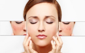 Bật mí 6 lời khuyên giúp chăm sóc da nhạy cảm tốt hơn