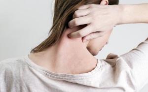 Dùng kem bôi thảo dược nào cho bệnh vảy nến?