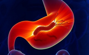 Khi nào vi khuẩn HP gây ra ung thư dạ dày?