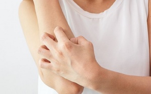 Làm dịu viêm da dị ứng với kem Eczestop