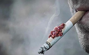 Có nên dùng TPCN Tumolung phòng ngừa phổi ung thư do hút thuốc lá?