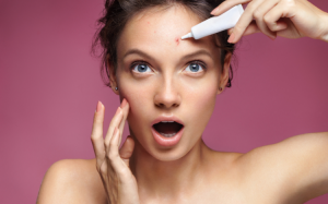 Làm sao để điều trị mụn trứng cá khi mang thai? 