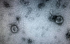 Việt Nam nuôi cấy và phân lập thành công virus nCoV trong phòng thí nghiệm