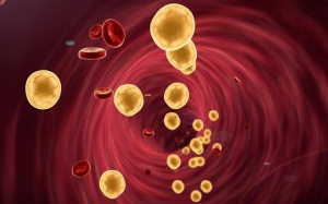 Thận trọng với mỡ máu cao, bước đệm dẫn tới bệnh tim mạch