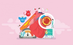 Những cách đơn giản để giảm cholesterol trong máu, phòng ngừa suy tim 