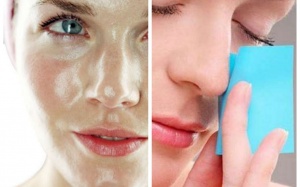 Da dầu dễ nổi mụn chọn kem chống nắng nào cho phù hợp?