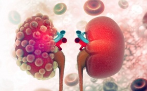 6 thực phẩm tốt cho thận giúp cơ thể đào thải độc tố