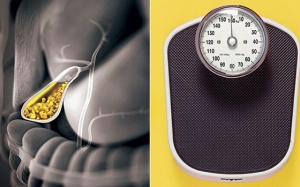 Giảm cân nhanh chóng có thể làm tăng nguy cơ bị sỏi mật