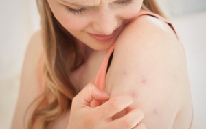 Bệnh Crohn ảnh hưởng như thế nào đến làn da phụ nữ?