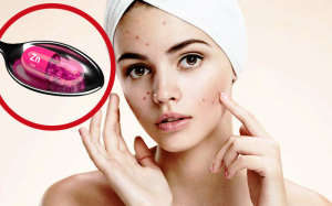 Muốn hết mụn, đừng chỉ đắp mặt nạ, hãy bổ sung kẽm