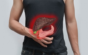 Hội chứng sau cắt túi mật là gì, ảnh hưởng thế nào tới sức khỏe?