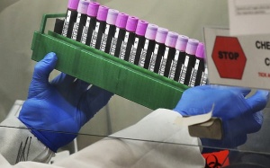 Robot có thể giúp thực hiện 3.000 xét nghiệm Covid-19/ngày