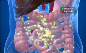 Nếu bạn không muốn béo phì, ung thư, hãy dừng ngay những việc này