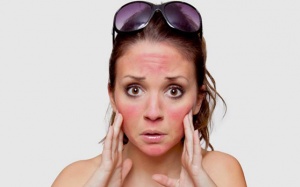 Biện pháp tự nhiên giúp làm dịu da, phục hồi làn da cháy nắng 