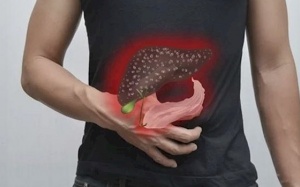 Người bị gan nhiễm mỡ nên ăn trái cây gì để kiểm soát bệnh?