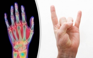 7 bài tập đơn giản cho người bệnh viêm khớp ngón tay