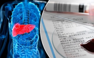 Phương pháp xét nghiệm máu mới giúp dự đoán được nguy cơ mắc xơ gan