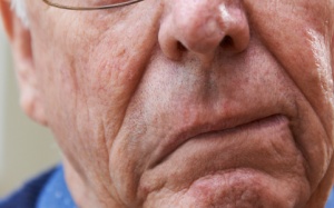 Cải thiện méo miệng, nói ngọng do tai biến bằng cách nào?