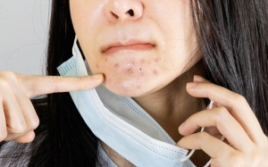 Giảm mụn, bảo vệ da mặt khi đeo khẩu trang mùa Covid-19