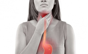 Thực phẩm cải thiện cơn ợ nóng ở người bị trào ngược acid