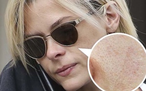 “Điểm mặt” những thói quen tai hại gây tắc nghẽn lỗ chân lông 