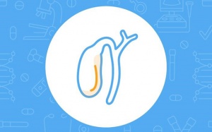 Polyp túi mật ác tính: Chẩn đoán và cách điều trị thế nào? 
