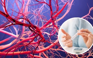 Biến chứng mạch máu nhỏ do đái tháo đường nguy hiểm thế nào?