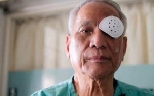 Cần kiêng gì sau phẫu thuật đục thủy tinh thể?