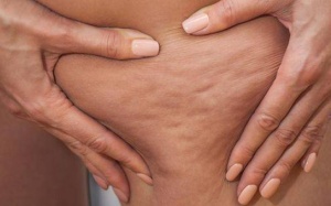 Người bệnh da sần vỏ cam nên ăn gì? 