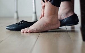 Người có biểu hiện phù nề do suy thận cần lưu ý gì về dinh dưỡng?